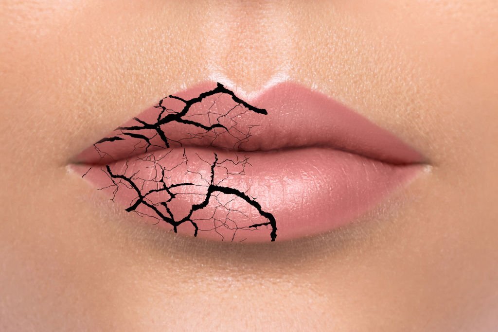 5 Tips for Healing Chapped Lips | Repair Your Lips